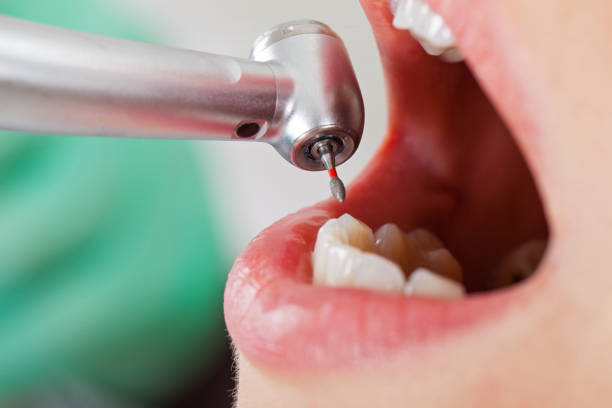 Best Mobile Emergency Dentist in Marlton, NJ
